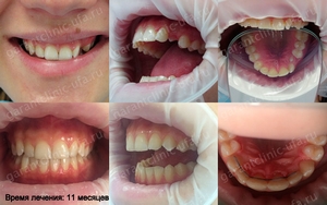 Скоби, клиника съвременната стоматология 