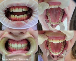 Скоби, клиника съвременната стоматология 