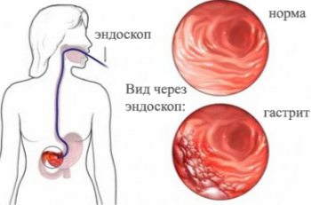 FGs стомашни как се извършват, обучение, четения, цени