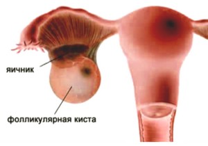 Follikulometriya при планирането на подготовката на бременността, поведение, оценка,