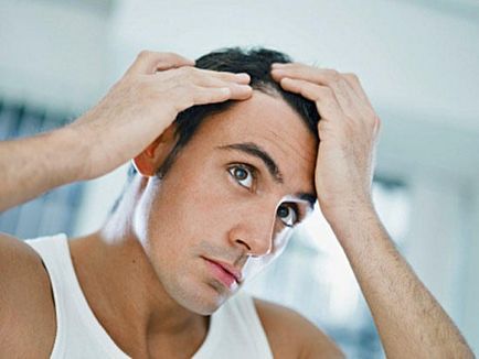 Как да се предотврати загуба на коса при мъжете