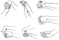 Как да се развива след счупване на пръст - на краката и ръцете