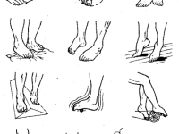Как да се развива след счупване на пръст - на краката и ръцете
