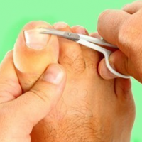 Как да премахнете загрубялата кожа от петите и краката у дома