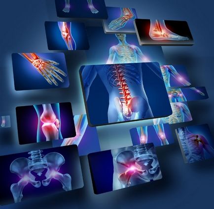 Как да се лекува болестта на първична остеоартроза съвременните методи на лечение и профилактика