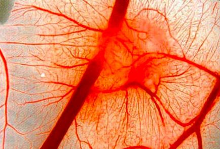 Как да се възстанови еластичността на кръвоносните съдове