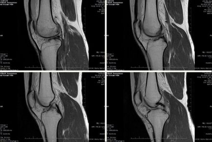 MRI на коляното, която показва обучение, четения