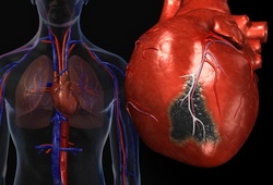 Появата на белези по сърцето причинява, лечение