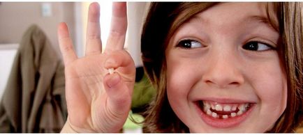 Премахване на млечните зъби при деца, ако болезнени последици