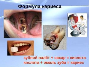 Както е оформен зъб