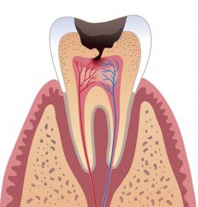 Както е оформен зъб