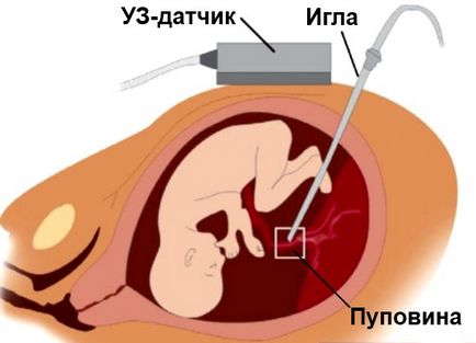 Скрининг както е