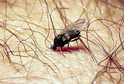 Алергични към ухапване от комари