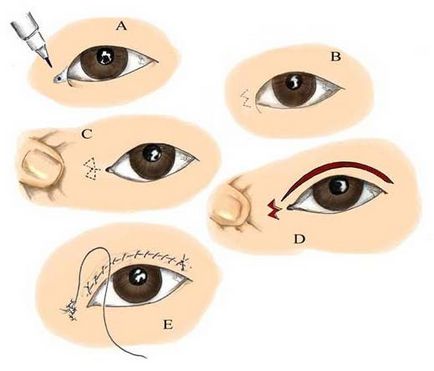 Как е азиатски формата на око
