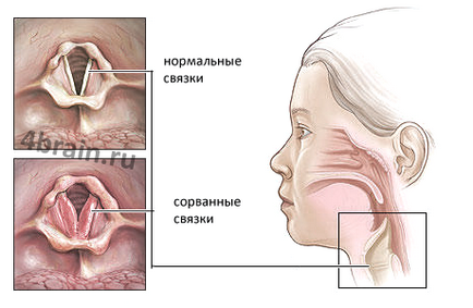 Какво да правите, ако разочарован глас