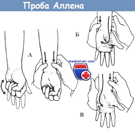 Каква е проба Алън