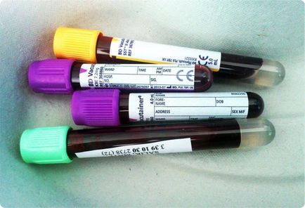 тест Hcv кръв какво е
