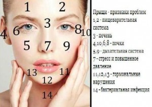 Как да се отървете от акне помощ Как да се отървете от акне помощ