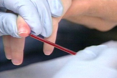 Как да наемете общ кръвен тест