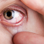 Диабетна ретинопатия симптоми, лечение, причини