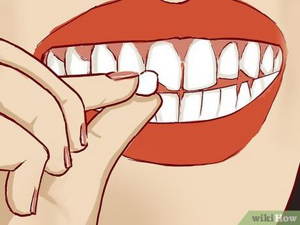Как за лечение на счупен зъб