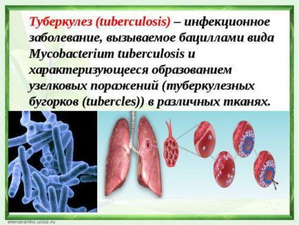 Как за лечение на белодробна туберкулоза в дома народната медицина, лекарства, предписания, възрастни