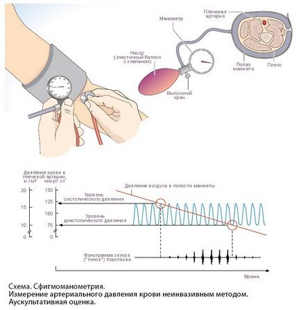 Методи за определяне на налягането без тонометър измерена налягане без устройство (апарат)
