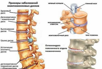 Болки в гърба какво и как да се лекува тежка и хронична болка
