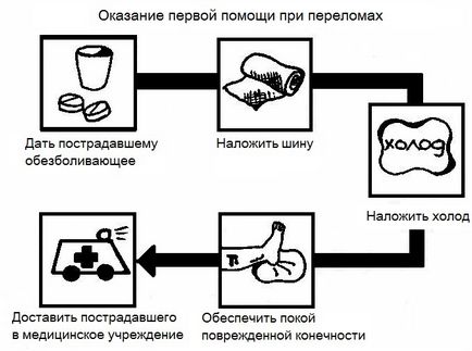 Счупени симптоми на краката, знаци и лечение