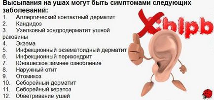 В причини силен сърбеж в ухото, обработва се с традиционните методи, използвайки мехлеми, капки (лечение) Той причинява силен сърбеж в ушите, лечение на традиционните методи, с помощта на мехлеми и капки