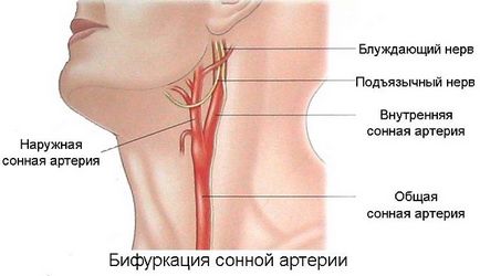 Сънната артерия се намира и къде би било, ако натиснете