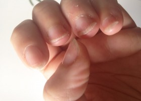 Biogel за укрепване на ноктите използвате, методи за приложение и отстраняване