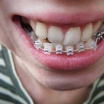 Скоби са отговорите на често задавани въпроси, истории на реални хора (популярни) Скоби са отговорите на често задавани въпроси, истории на реални хора