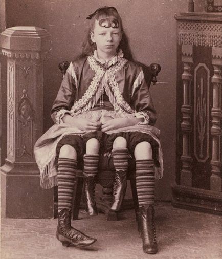 Момиче от раци, жив скелет, полу-Man и други циркови уроди (Circus) Момиче от раци, жив скелет, полу-Man и други циркови уроди