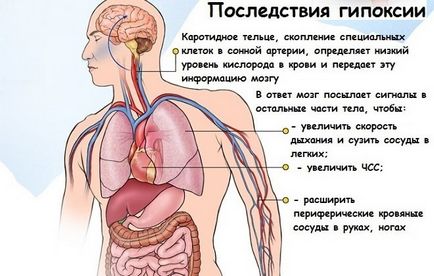церебрална хипоксия какво е, липсата на кислород, симптоми, лечение (а) церебрална хипоксия какво е, липсата на кислород, симптоми, лечение