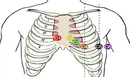 Как се прави ЕКГ