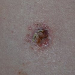 Миризми и изолация на пъпа (лошо) Мирис и освобождаване от пъпа