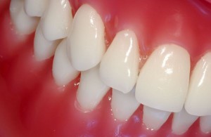 Защо сърбящи зъбите и венците са възрастни или тийнейджър