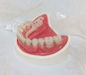 Зъбни протези нови съвременни технологии и видове