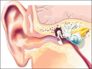 Слух - причини, симптоми и лечение за хора с увреден слух