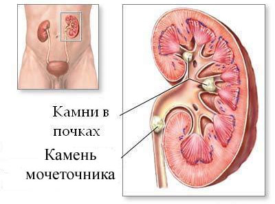 Стомашни спазми какво да правя, причинява симптомите, пречиствателни таблети и народни средства