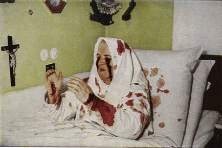 Стигмата на вътрешна и външна (4 снимки) (стигмата) Стигмата на вътрешни и външни (4 снимки)