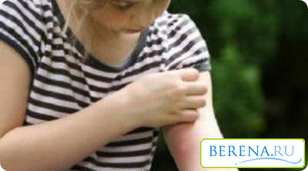 ухапване от комар при децата, лекувани