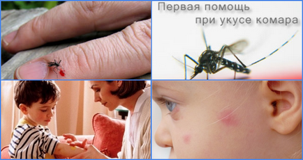 Какво трябва да помаже ухапване от комар дете