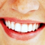 Фотоизбелващ зъбите преди и след снимки, преглед на сегашните системи