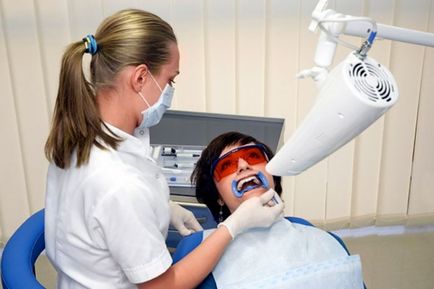 фотоизбелване зъби - процесът на процедурата, противопоказанията и резултатът за пациента