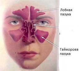 Синузит симптоми, причини и лечение на синузит