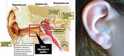 Как капково водороден пероксид в почистването на ухо ухо на задръствания в детето