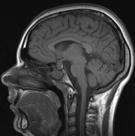 Как да се провери на съдовете на мозъка, диагностика, методите