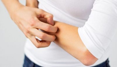Как да се облекчи сърбежа алергии - Преглед на ефективни лекарства
